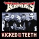 THE TERMITES – Kicked In The Teeth - LP